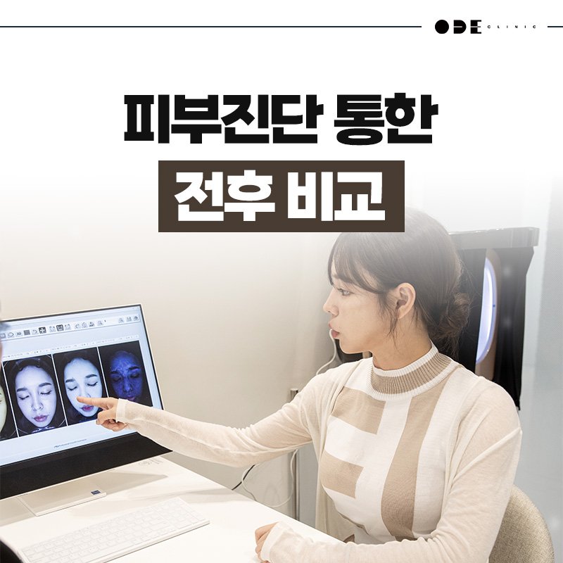 강남 필러 원장 직접 시술